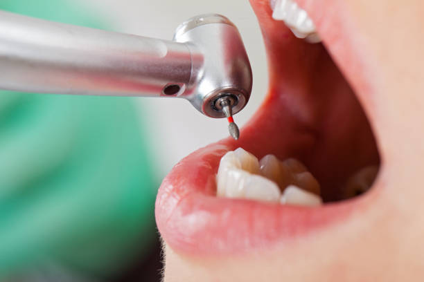 Best Emergency Denture Repair in Jefferson, LA